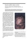 Essential Syphilitic Alopecia Revisited