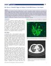 Hair Dye as a Potential Trigger for Relapse of Anti-GBM Disease: A Case Report