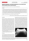 Rapunzel Syndrome: A Rare Form of Trichobezoar in the Stomach with Extension into the Small Intestine