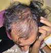 About my regrowth journey