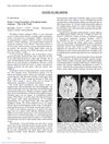 Writer’s Cramp Presentation of Woodhouse–Sakati Syndrome – Out of the Woods