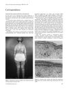 Late Presentation of Myotonic Dystrophy