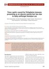 Tinea Capitis Caused by Trichophyton Tonsurans Presenting as Obscure Patchy Hair Loss Due to Daily Antifungal Shampoo Use