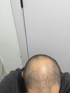 Is this regrowth