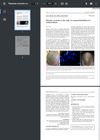 Pityriasis Versicolor on the Scalp: An Unusual Distribution of a Common Disease