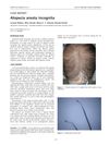 Alopecia Areata Incognita: A Case Report
