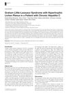 Graham Little-Lassueur Syndrome with Hypertrophic Lichen Planus in a Patient with Chronic Hepatitis C