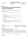 Hair Growth in a Patient with Alopecia Areata on Tocilizumab