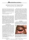 Latanoprost-Induced Skin Depigmentation