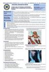 A Rare Case of Vitamin D Dependent Rickets Type-2A Presented as Alopecia Totalis