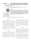 Acantholytic Hair Casts: A Dermoscopic Sign of Pemphigus Vulgaris of the Scalp
