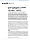 Basal Cell Carcinoma of the Scalp Shows Distinct Features from the Face in Asians