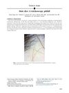 Hair Dye: A Trichoscopy Pitfall