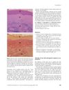 Attitudes of Men with Androgenetic Alopecia to Sun Protection