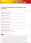 Cutaneous Manifestations of Polycystic Ovary Syndrome