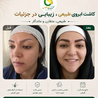 🌿 کاشت ابرو؛ بازگشت زیبایی طبیعی به چهره شما

ابروها نقش مهمی در زیبایی و جذابیت صورت دارند. اگر به