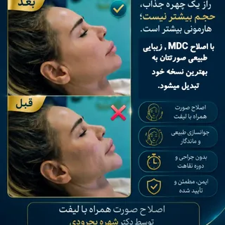 ✨ اصلاح فرم صورت؛ ترکیبی از زیبایی، لیفت و جوانسازی

با افزایش سن یا کاهش حجم صورت، ممکن است زاویه ف
