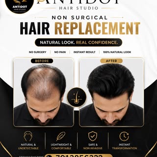 Say goodbye to hair loss and hello to confidence! ✨

Transform your look instantly with Non-Surgical