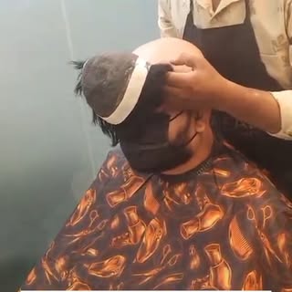 🔥 Get Your Confidence Back with Advanced Non Surgical Hair Replacement in Hyderabad at Antidot Hair