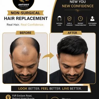 🚨 Baldness affecting your confidence?
Get a natural-looking transformation with advanced Non-Surgic