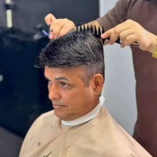 #protesecapilar #cabelo #trasplante #calvicie #careca