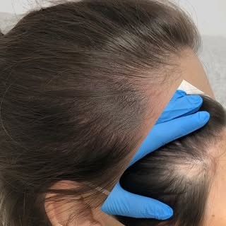 3️⃣…2️⃣…1️⃣…. 💣Nadrabiam instagramowe zaległości 😎

Efekt 3 sesji #scalpmicropigmentation 

Natura