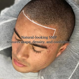 Hair loss can quietly affect how you see yourself every day.

This transformation was designed to re
