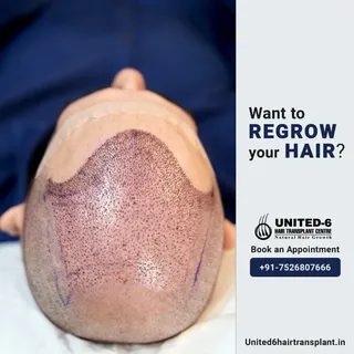 Want to regrow your hair? Then we have a solution for you.
Visit our clinic today and get a free con