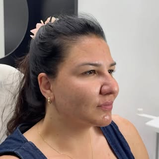 Is it possible to look more refreshed and lifted without changing your facial features?

Over time, 