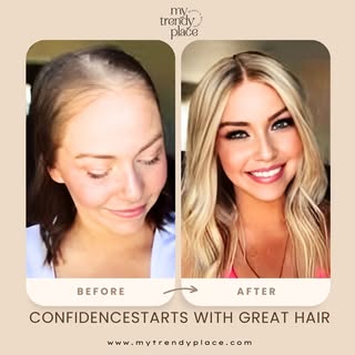 Tired of wearing low-quality wigs that won't stay in place? Want a unit that looks realistic and eas