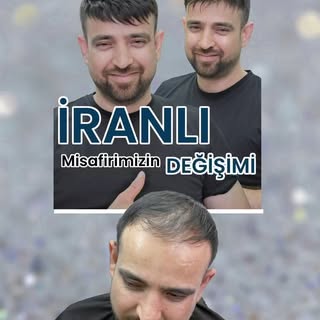İranlı Ahmet Bey’in Harika Değişimi! ✨ 

Merkezimize İran’dan konuk olan değerli misafirimiz Ahmet B