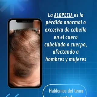 Cada vez más personas consultan por su salud capilar. Hombres y mujeres persiguen mantener su cabell