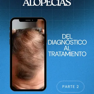 Continuando con nuestro tema de alopecia, un breve resumen de las opciones de diagnóstico y tratamie