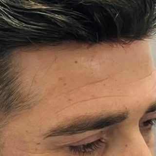 Bölgesel Protez Saç Çözümleri Doğallığı ve konforu bir arada yaşayın.
