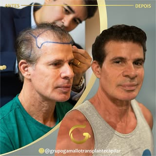 Que golaço foi essa transformação do nosso tão querido Túlio Maravilha @tuliomaravilha_oficial 
Um c