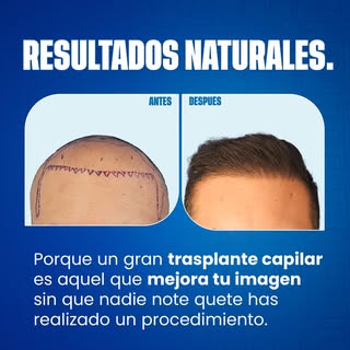 ¿Qué estás esperando? No lo pienses más!
Agenda tu CITA 👇
https://bit.ly/Diolaserpr
Visítanos en
ht