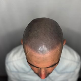 Précision. Subtilité. Maîtrise.

Cette transformation repose sur un travail point par point, où chaq