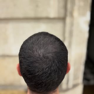 Sous la lumière, tout se révèle… mais certaines transformations racontent encore plus.

Première pho