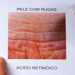✨ Nem toda pele precisa do mesmo tratamento. O segredo está em usar o ativo certo para a necessidade