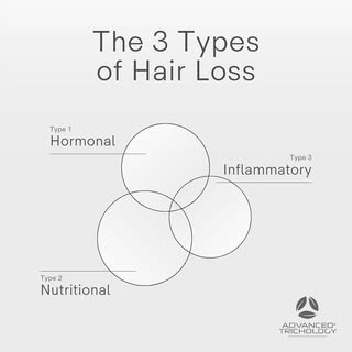 Zone Hair Pull Test + blood work = a clearer picture of the type(s) of hair loss you’re dealing with