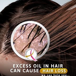 Excess oil is an indicator of scalp problems.

It is the terror (not only for women) that can cause 