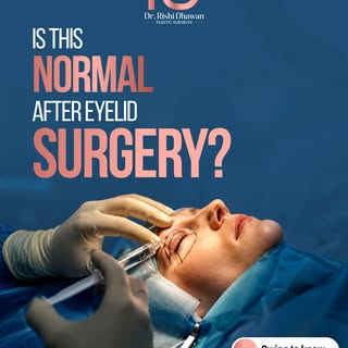 Is This Normal After Eyelid Surgery? 👁️

Recovery after eyelid surgery is a gradual process, and kn