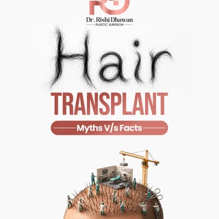 Hair Transplant: Myths vs Facts**

Hair transplant is an effective solution for hair loss, but knowi