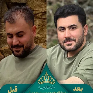 ✨ گاهی فقط یک تغییر کوچک، چهره را سال‌ها جوان‌تر نشان می‌دهد...

جهت دريافت مشاوره کلمه نوبت را ارسا