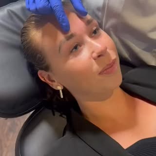 Klaar voor de zomer? ☀️ Voorkom hoofdpijn door je frons te ontspannen met Botox! 🤩💉 Tot snel, bij 