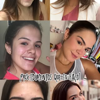 A médica dermatologista Dra. Alexia Lima [@alexialimadermato], que tem grande expertise em alteraçõe