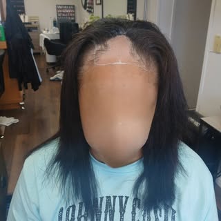 I bonded Lace Closure to achieve this look on a client with Trichotillomania.