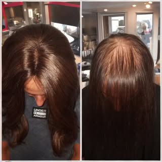 I applied a topper to a client with  Female Pattern Baldness.