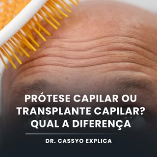 Cabelos que são seus para sempre? Sim, é possível!

Assista este vídeo que o doutor Cassyo te explic