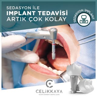 #dentalimplant 
#celikkayaclinic💎
